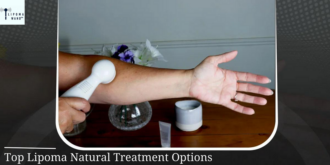 How to Get Rid of a Lipoma Naturally on Your Own