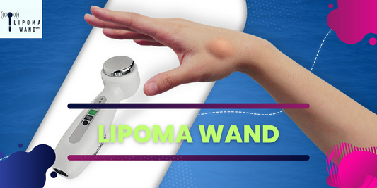 Use the Effective Natural Aid for Lipoma Treatment-Lipoma Wand