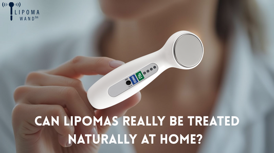 Can Lipomas Really Be Treated Naturally at Home? Exploring New Treatments and Non-Surgical Options