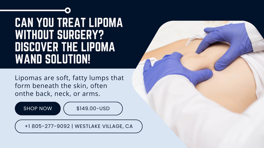 Can You Treat Lipoma Without Surgery? Discover the Lipoma Wand Solution!