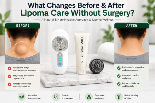 What Changes Before & After Lipoma Care Without Surgery Now
