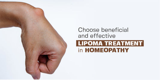 Effective Lipoma Homeopathic Treatment Options Explained