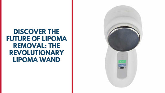 Discover the Future of Lipoma Removal: The Revolutionary Lipoma Wand