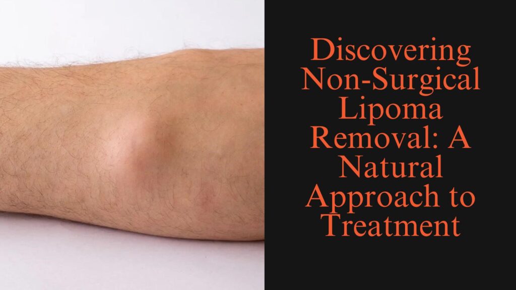 Discovering Non-Surgical Lipoma Removal: A Natural Approach to Treatment