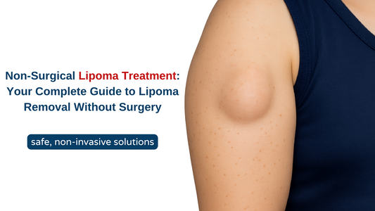 Non-Surgical Lipoma Treatment