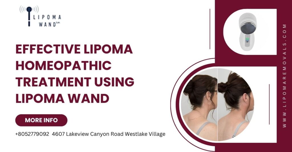 Effective Lipoma Homeopathic Treatment Using Lipoma Wand