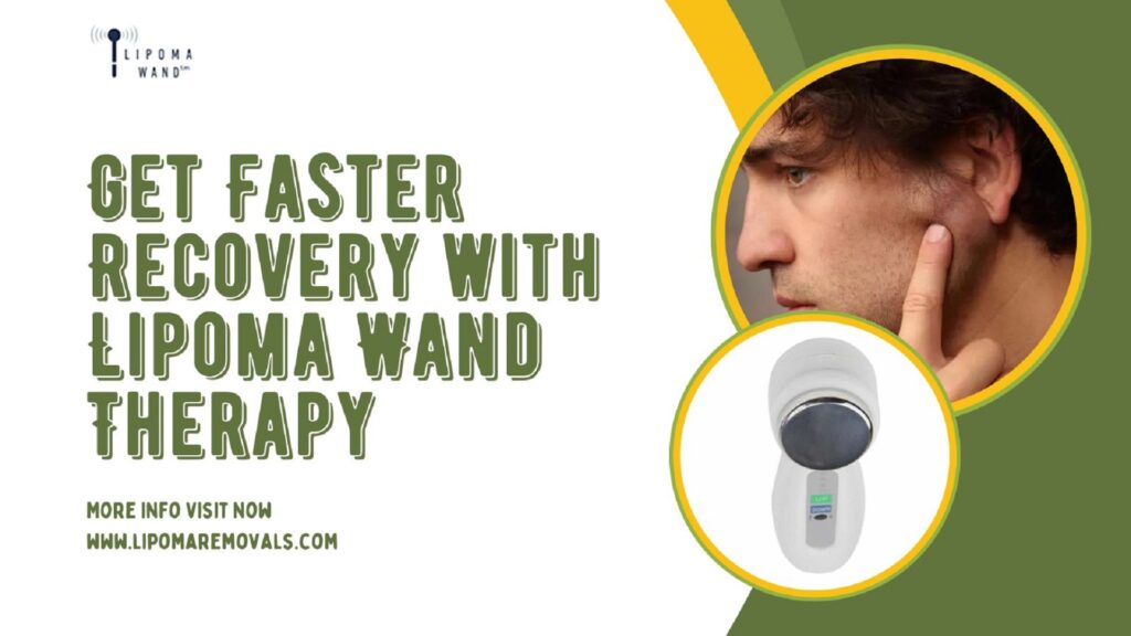 Get Faster Recovery with Lipoma Wand Therapy