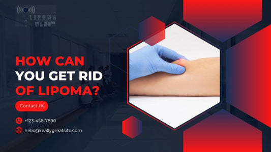 How can you get rid of lipoma?