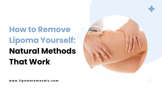 How to Remove Lipoma Yourself: Natural Methods That Work