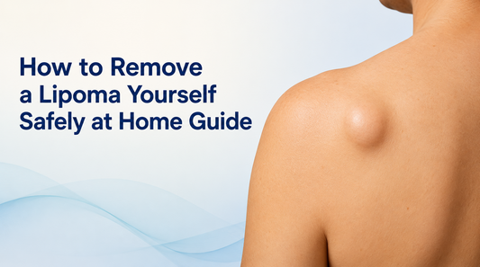 How to Remove a Lipoma Yourself Safely at Home Guide Today?