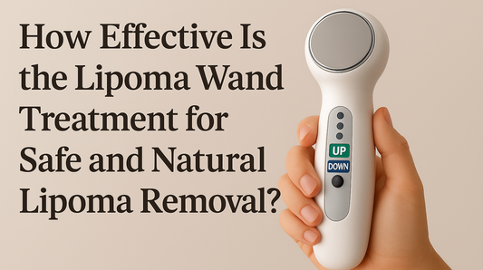 How Effective Is the Lipoma Wand Treatment for Safe and Natural Lipoma Removal?