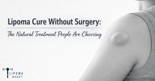 Lipoma Cure Without Surgery: The Natural Treatment People Are Choosing