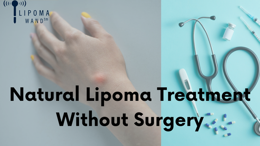 Natural Lipoma Treatment Without Surgery