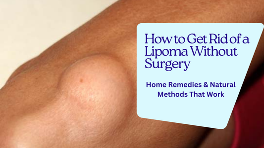 How to Get Rid of a Lipoma Without Surgery: Home Remedies & Natural Methods