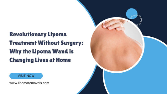Revolutionary Lipoma Treatment Without Surgery: Why the Lipoma Wand is Changing Lives at Home
