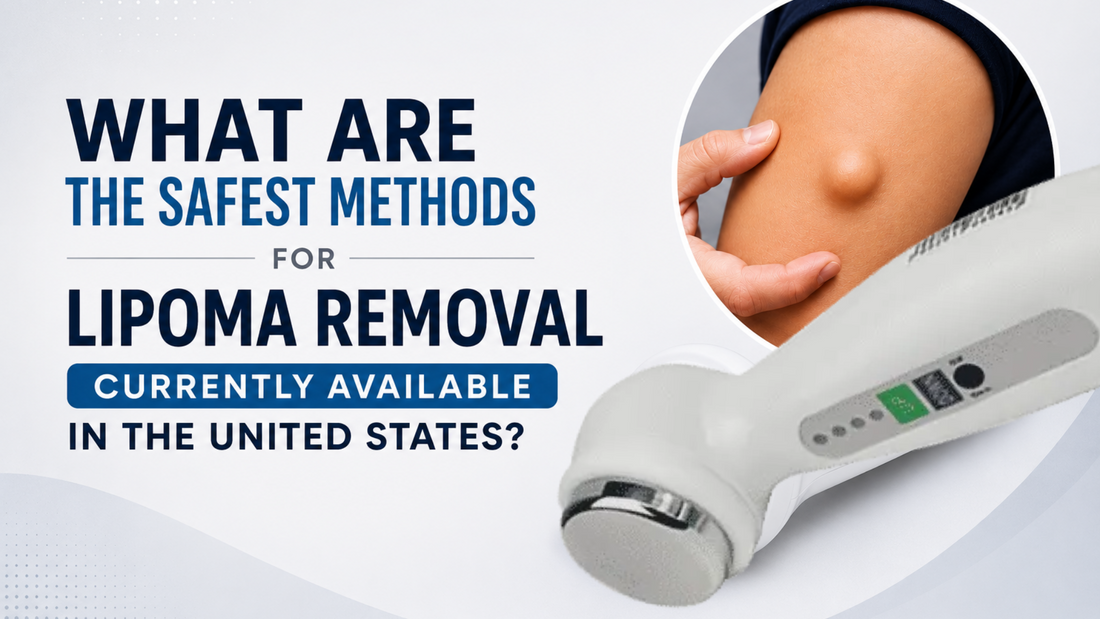 What Are the Safest Methods for Lipoma Removal Currently Available in the United States?