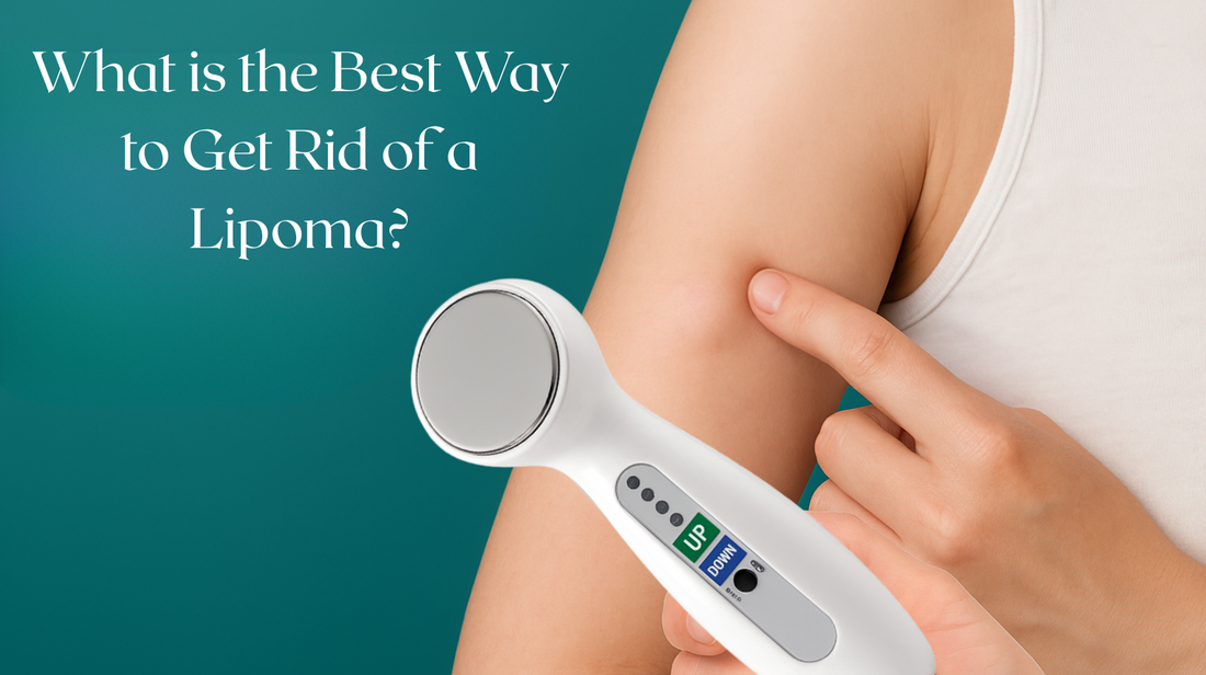 What is the Best Way to Get Rid of a Lipoma?