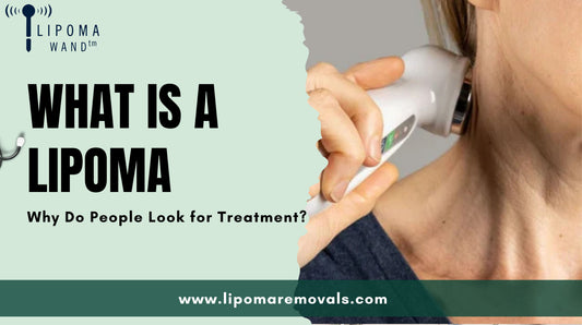 What Is a Lipoma and Why Do People Look for Treatment?
