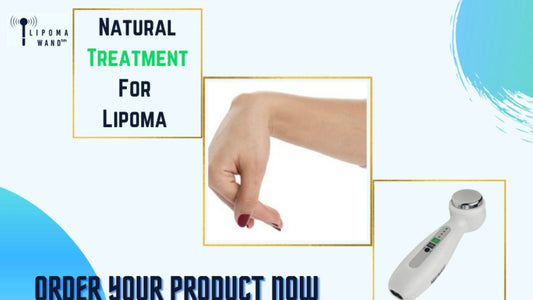 Lipoma Wand – A Natural Home Treatment