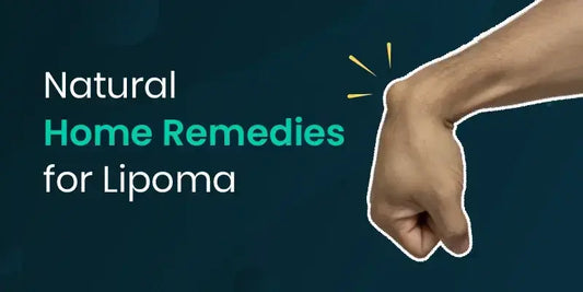 Lipoma Treatment: How to Remove Lipomas at Home During COVID-19