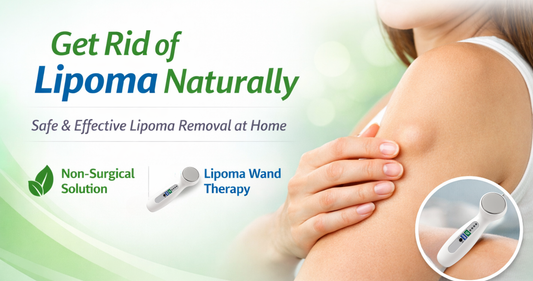 Get Rid of Lipoma Naturally: A Safe and Effective Approach That Works