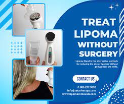 Use Natural Home Remedies for Curing Lipoma without Surgery