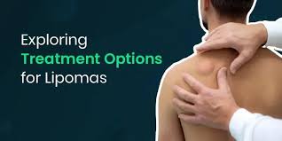 What is Lipoma and what is the non-surgical Lipoma treatment available?