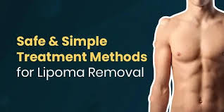 How Safe is the Natural Lipoma Treatment?