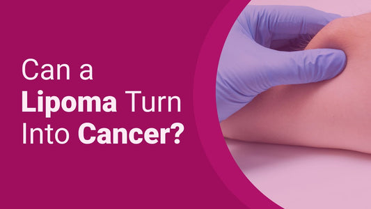 Can Lipoma be Cancerous? | Lipoma Wand