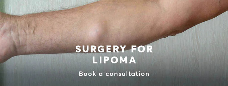 How can you get rid of lipoma?