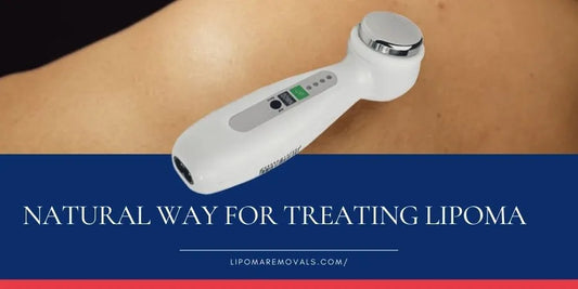 Use Lipoma Wand Therapy For Quick and Safe Lipoma Removal