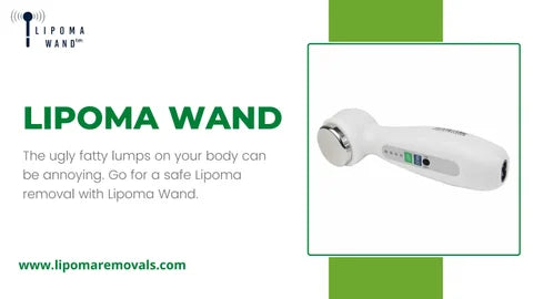 Get the Best Lipoma Natural Treatment with Inexpensive Lipoma Wand