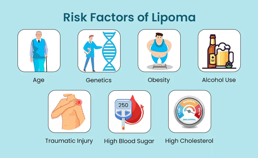 Get to Know Risk Factors of Lipoma. How it Can be Removed?