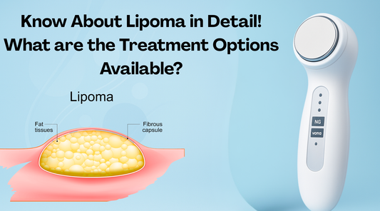 lipoma treatment