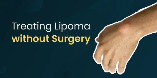 Know How Lipoma Can Be Treated Without Surgery