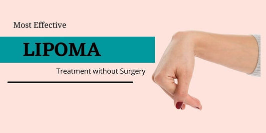 Most Effective Lipoma Treatment without Surgery