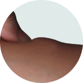 Soft, movable lumps
under the skin